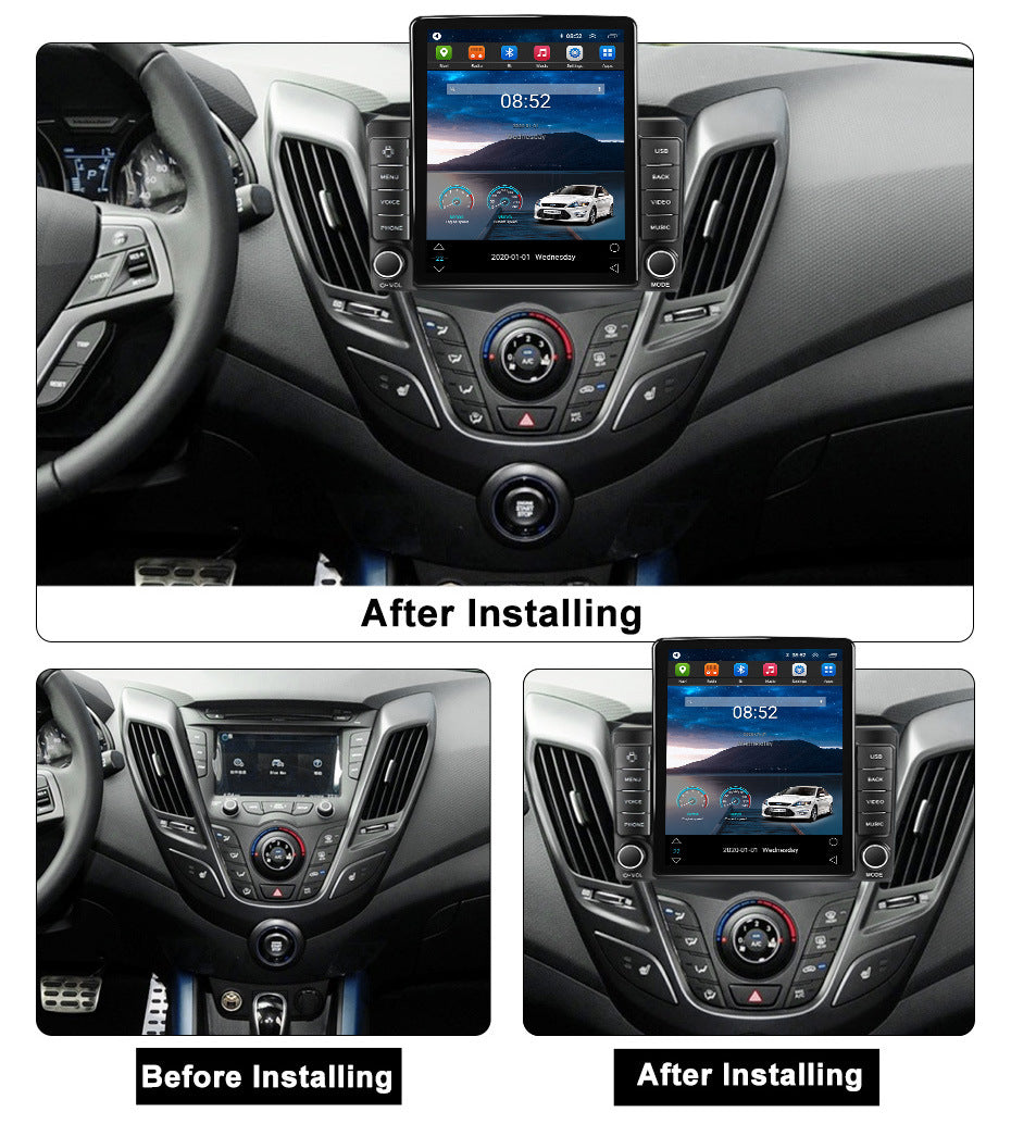 Suitable for hyundai veloster android navigation system with carplay (vertical screen, stone tablet style)