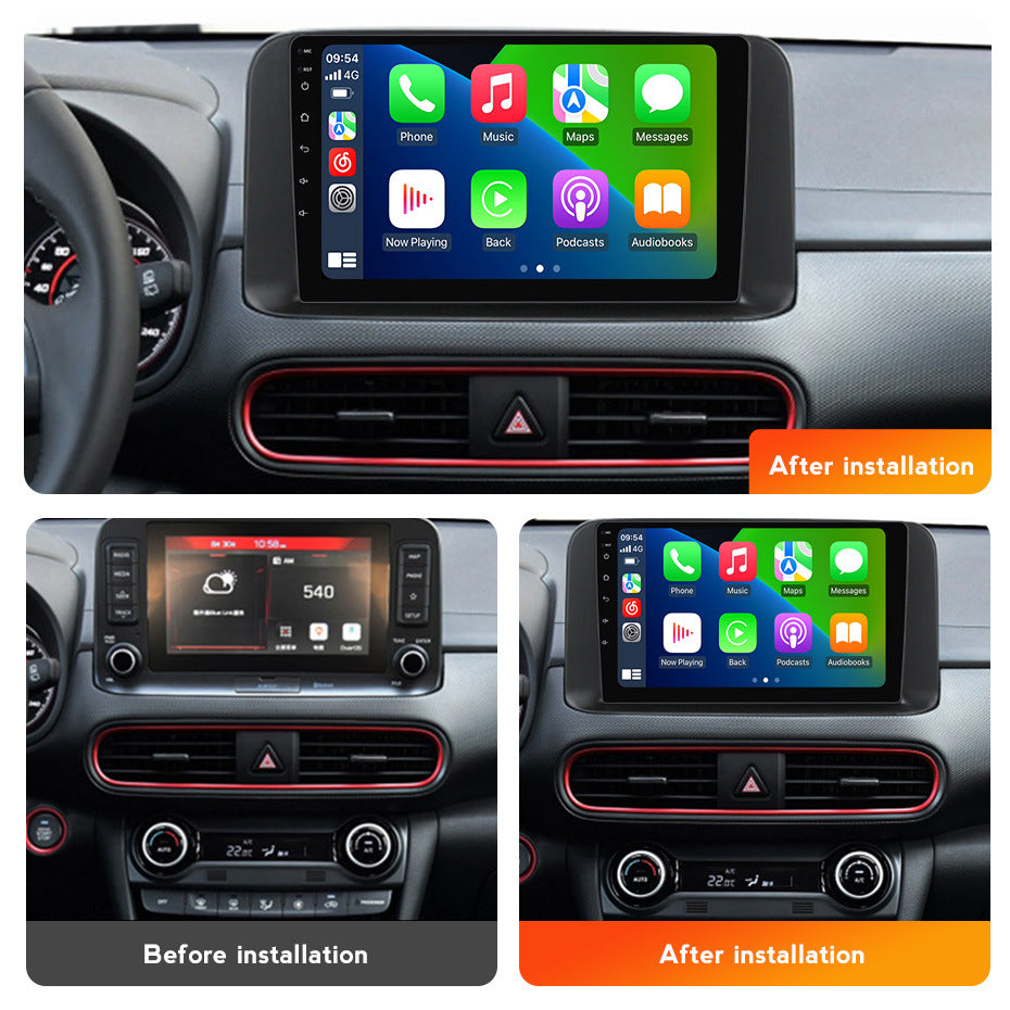 Suitable for hyundai encino 2018-2020 hyundai encino radio car android navigator