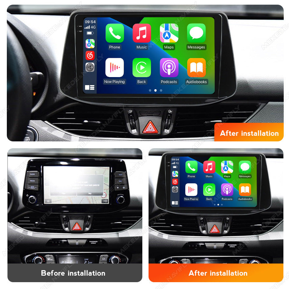 Suitable for 1din_hyundai i30 2018 hyundai i30 car smart central control android navigator motherboard