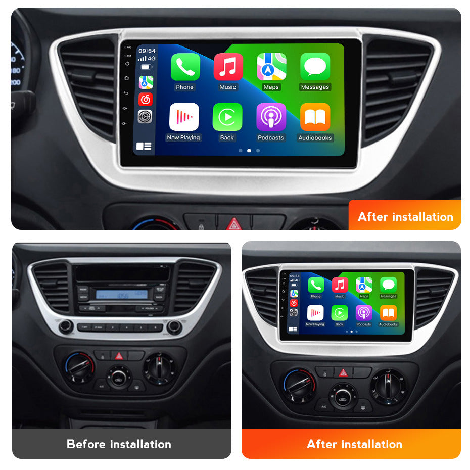 Suitable for hyundai verna accent 2017-2018 android car navigation