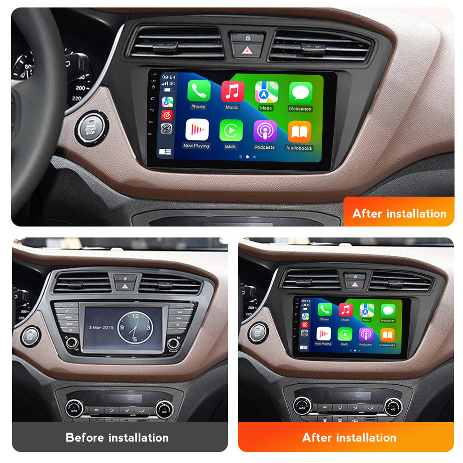 Suitable for hyundai i20 2015-2017 hyundai i20 left-hand drive right-hand drive large screen android car navigation